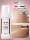 Кератолитик карбамидный "Пенное лезвие" Gel-Off Professional, 150 мл 12305